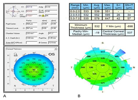 normal cornea size chart